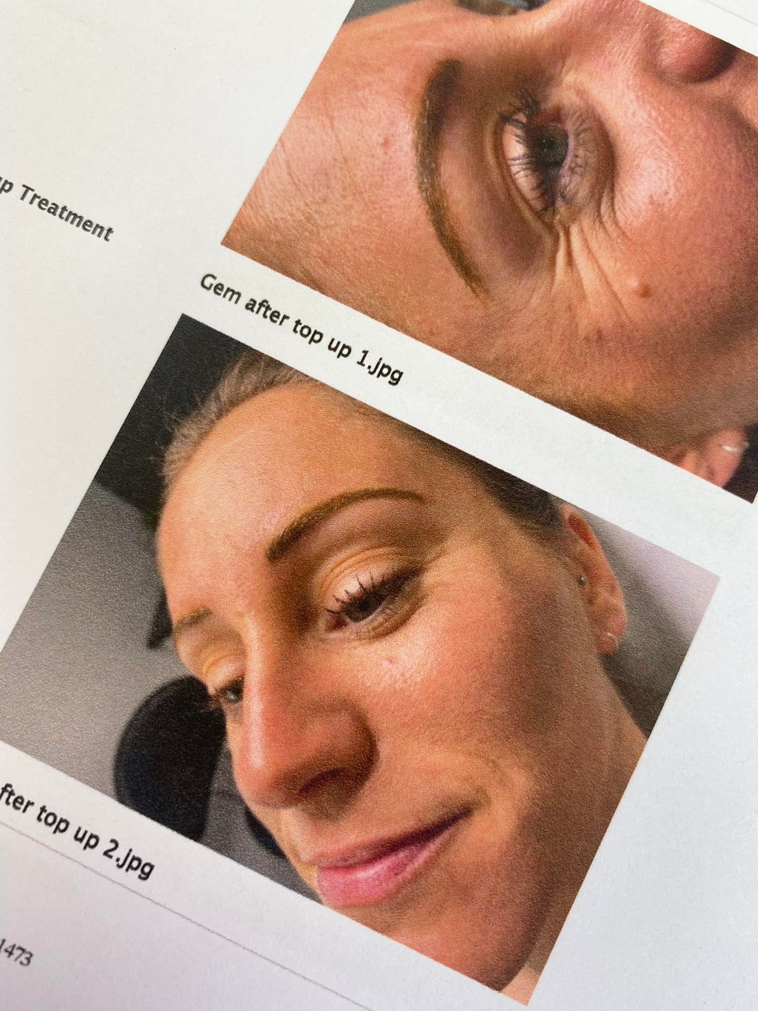 Laura's case study portfolio image of a finished brow procedure