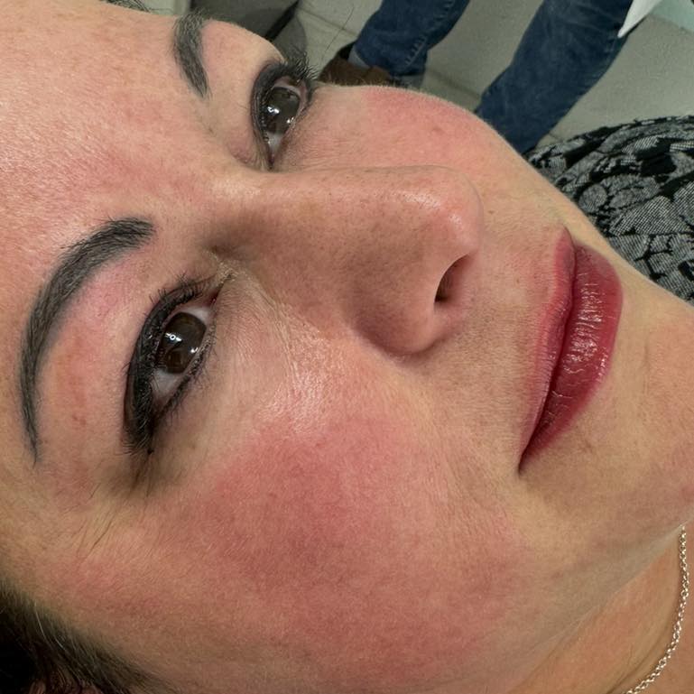 Susan's client after permanent lip treatmennt